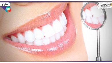 5 طرق فعالة لحماية الأسنان من البلاك