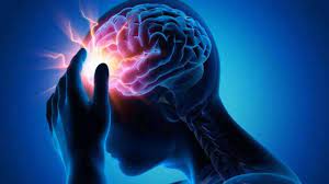 دراسة: عادات شائعة يمارسها الكثير تؤدي مع الوقت للإصابة بالسكتة الدماغية
