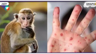 بعد المغرب تسجيل أول إصابة بجدري القردة في لبنان
