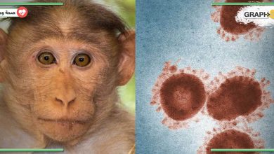 العثور على نوعين مختلفين من جدري القرود في أمريكا مما يزيد من لغز الوباء
