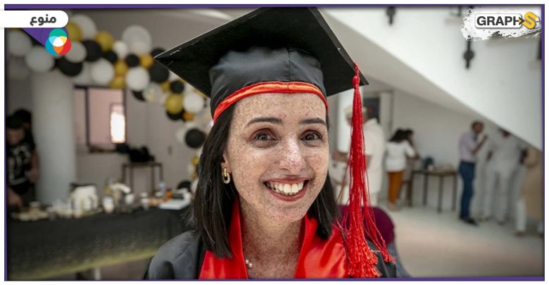 لمياء حكيم فتاة تونسية تحصل على لقب "أول امرأة من أطفال القمر في العالم" تحصل على درجة الدكتوراه
