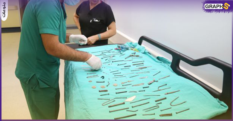 مسامير وسكاكين وملاقط إزالة 158 قطعة من معدة امرأة في تركيا ..صور