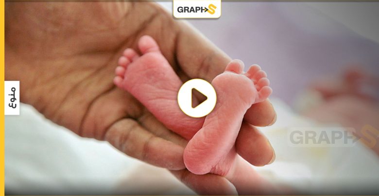 بالفيديو || ولادة نادرة لطفل بملامح رجل عجوز