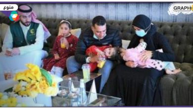 شاهد: نجاح فصل التوأم السيامي المصري سلمى وسارة بعد عملية جراحية معقدة بالسعودية